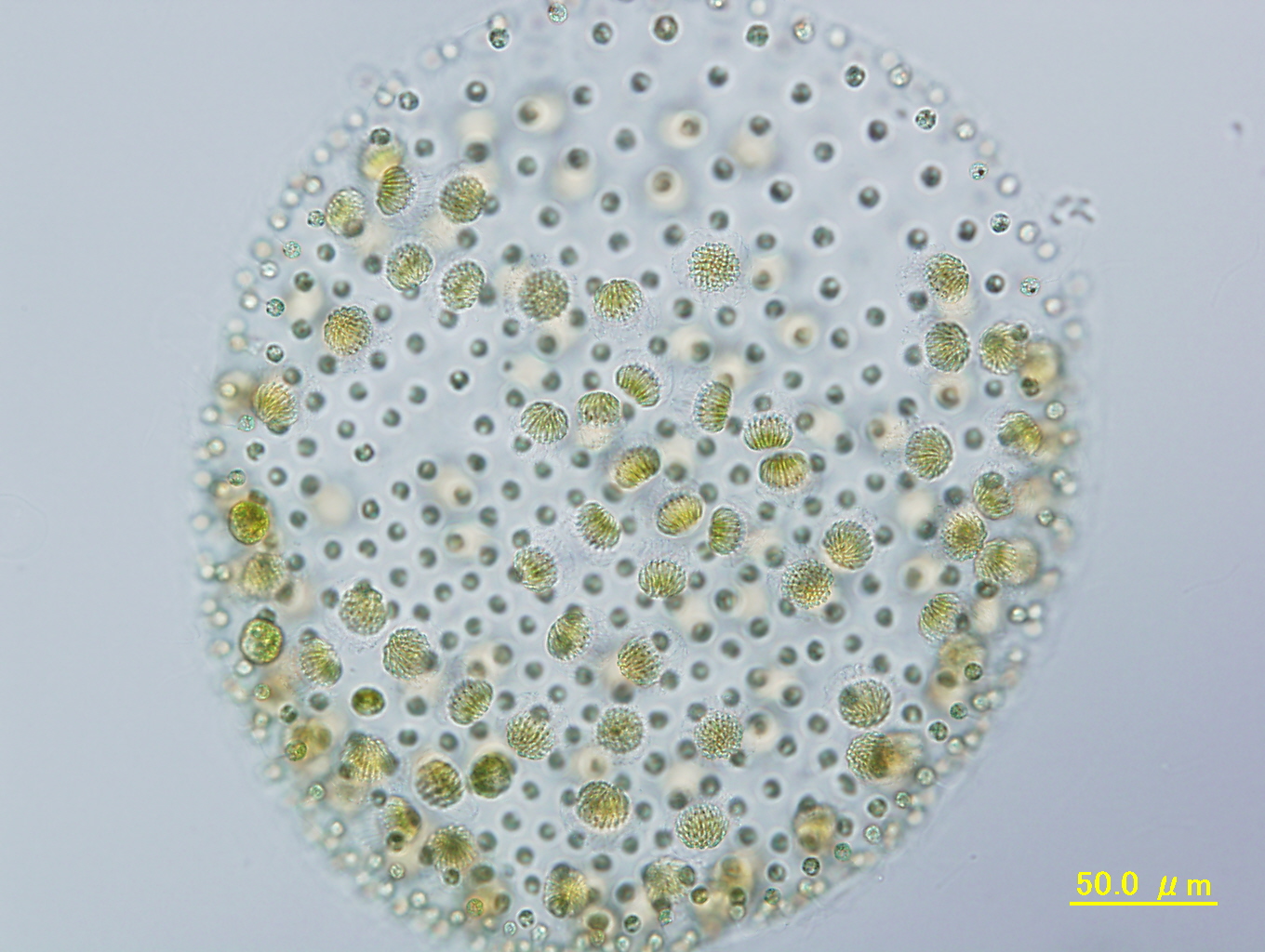 Male spheroid showing sperm packets (bundles of male gametes)