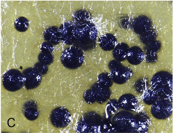 Ascomata of Boothiella tetraspora [Image credit: Wang, et al. 2019. CC BY-NC-ND 4.0]