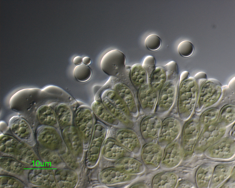 Micrograph of Botryococcus braunii. 