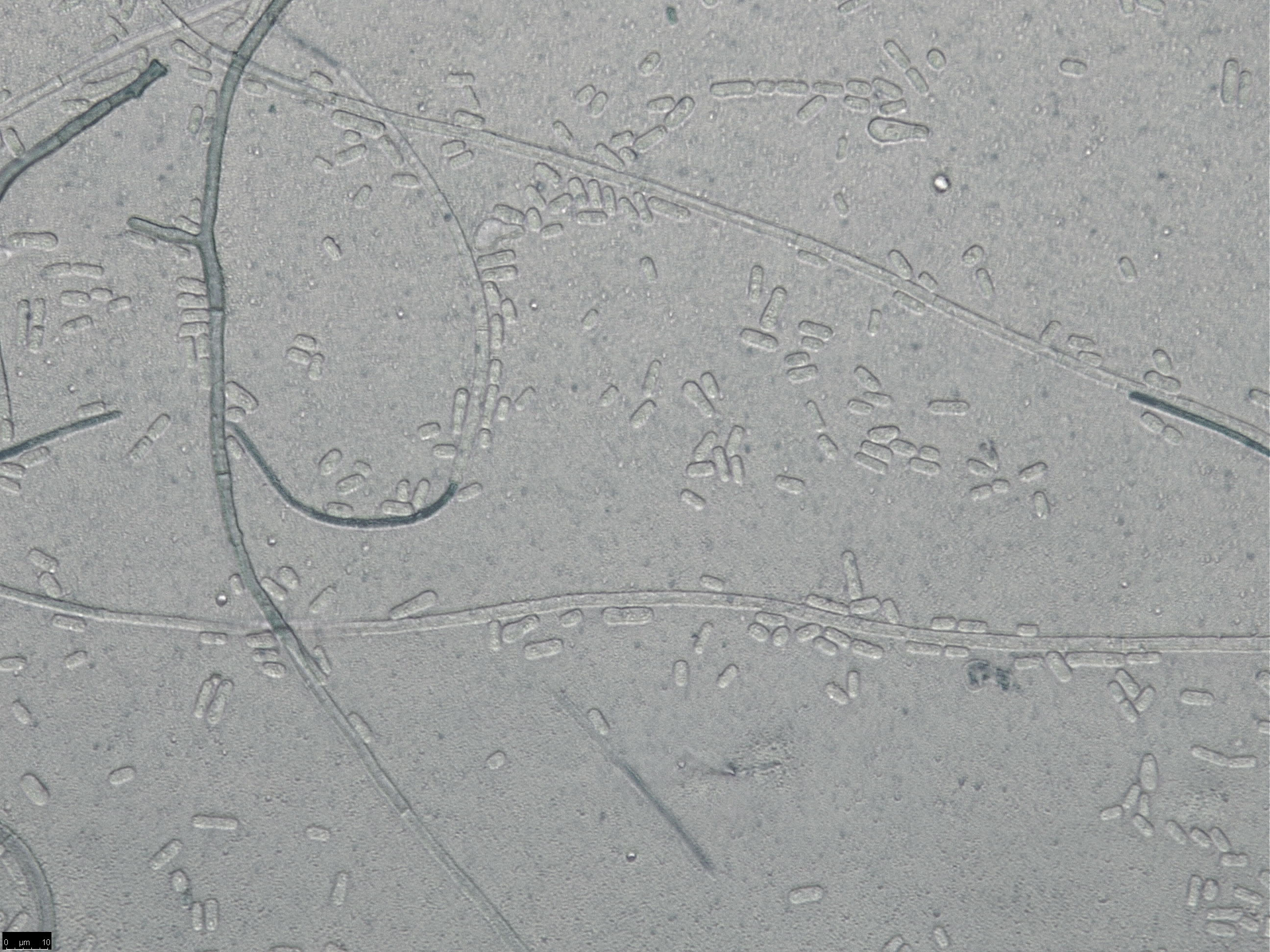 Endoconidia from culture (asexual spore state of Bretziella fagacearum)