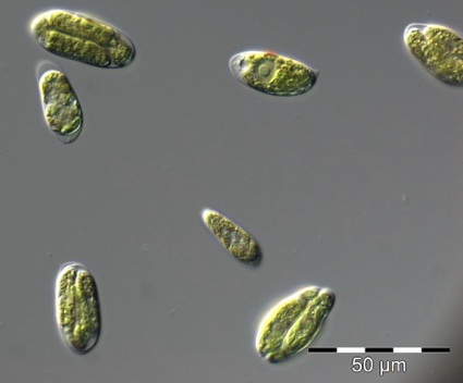 The psychrophilic strain CCCryo 005-99 of Chloromonas remiasii (Chlamydomonadaceae, Chlorophyta). Single cells show the original morphology with a lateral stigma, central nucleus and the characteristic posterior elongation (top middle). Usually cells form 2-celled or 4-celled sporangia (bottom right and top left). Flagella are often shed in cultures. [Photo credit: Thomas Leya, Fraunhofer IZI-BB]