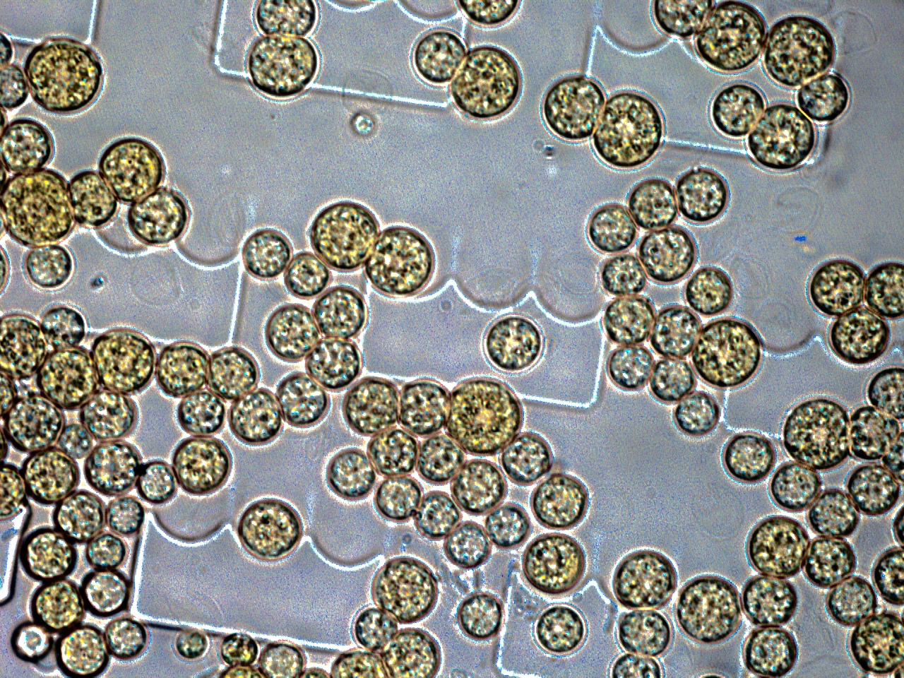 Micrograph of Chromochloris zofingiensis