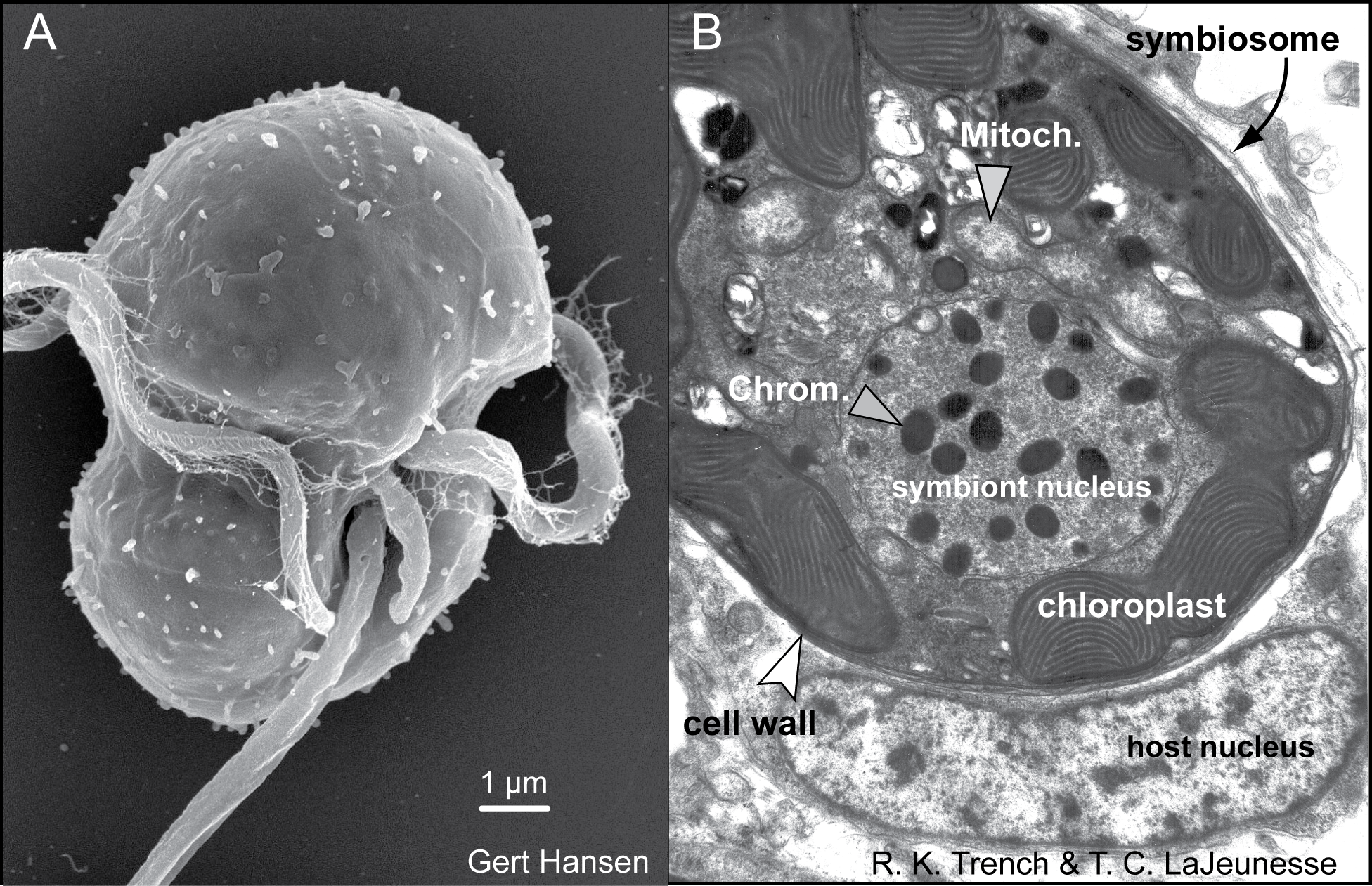 (A) Electron micrographs of a Symbiodinium mastigote (motile cell)
with characteristic gymnodinioid morphology and (B) the coccoid
cell in hospitæ. Image and caption from Wikipedia under CC BY-SA 4.0 by Dr. Alison Lewis