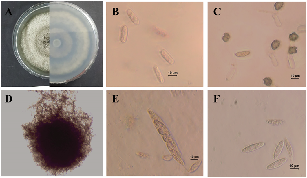 Photo of Colletotrichum plurivorum LFN00145