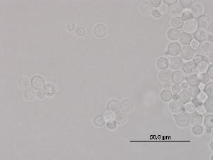 Cryptococcus vishniacii