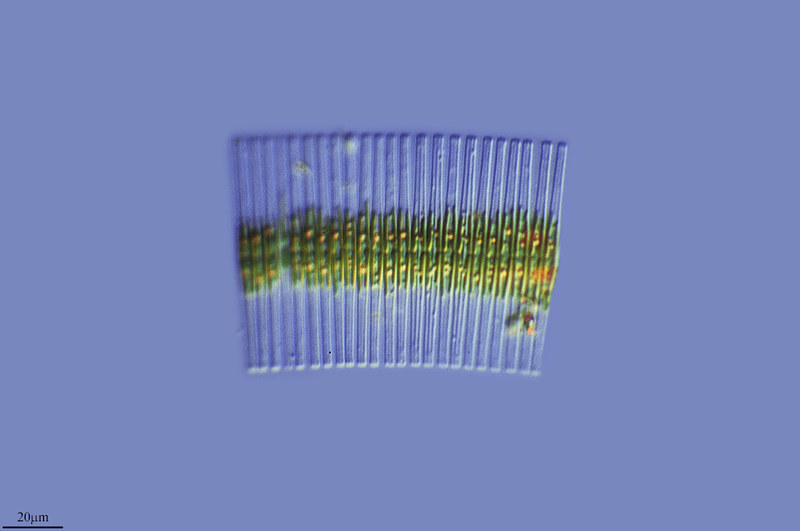 Micrograph of Fragilaria crotonensis