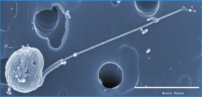Micrograph of Micromonas RCC835