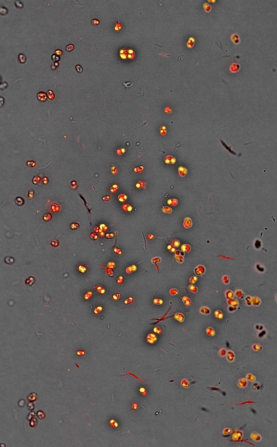 Confocal microscopy image of Nannochloropsis gaditana