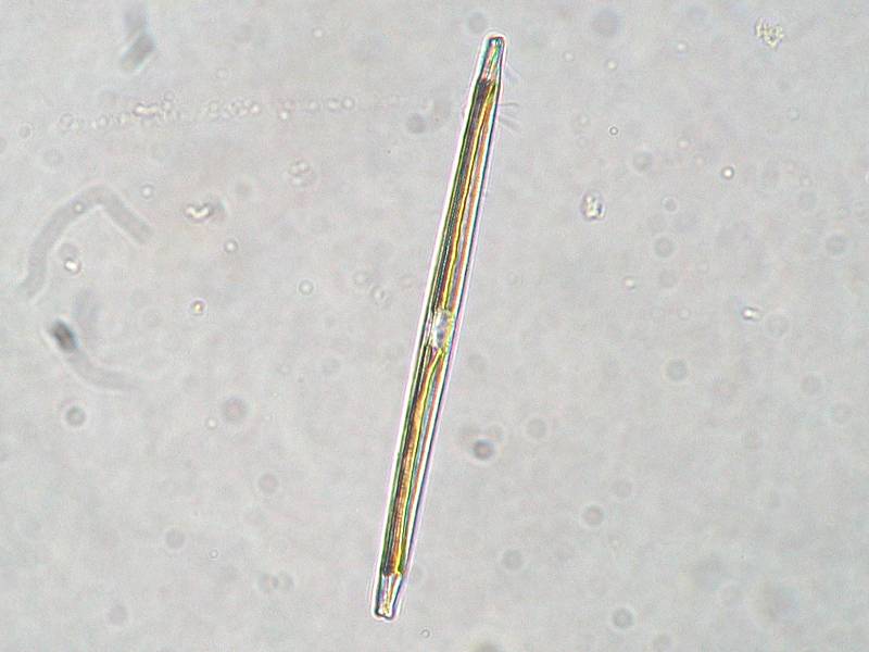 Nitzschia sp. micrograph
