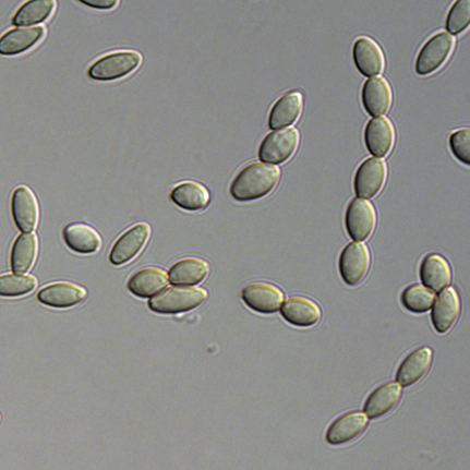 Conidia of Paecilomyces variotii strain CBS 144490.  P. variotii produces large numbers of these airborne asexual spores, each of about 10 µm in length.  Image provided by Andrew Urquhart.