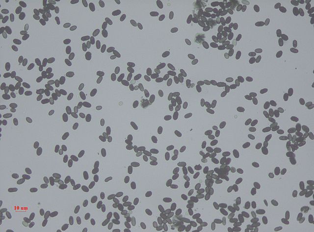 Stachybotrys spores 10 X 40 magnification under bright field microscopy.