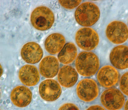 Micrograph of Symbiodinium