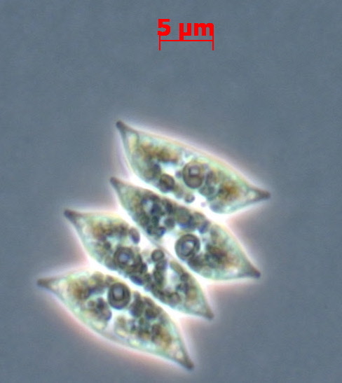 Photo of Tetradesmus obliquus UTEX B 72 v1.0