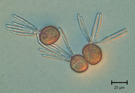 Germination of T. maclaganii teliospores.  Photo by Christine Layton.