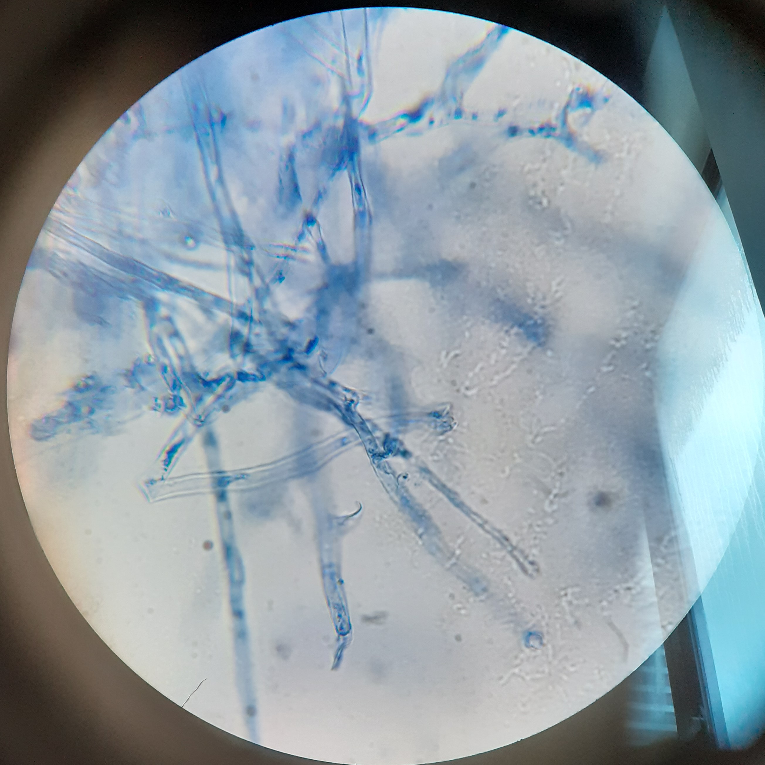 Photo of Trichoderma sp. AM6 v1.0