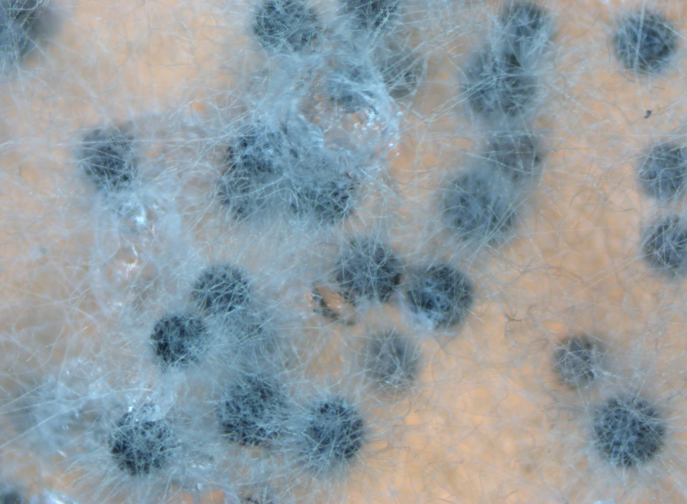 Perithecia of Zopfiella macrospora. [Image Credit: Pr. Philippe Silar, Université Paris Cité.]