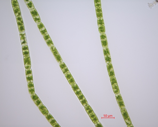 Zygnema circumcarinatum UTEX 1560 [Image credit: Xuehuan Feng]
