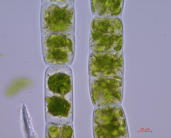 Zygnema circumcarinatum SAG 698-1b [Image credit: Xuehuan Feng] 