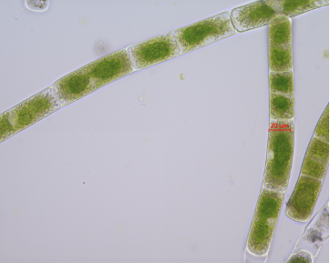 Zygnema cf. cylindricum SAG 698-1a [Image credit: Xuehuan Feng]